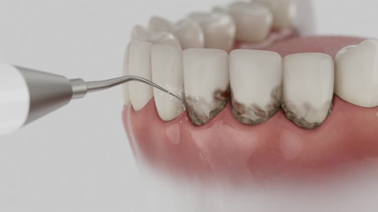 Reliable Emergency Dentist contractor in Green Valley, SD by Smile Center Dentistry